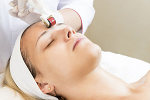 Microneedling